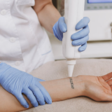 curso de remoção a laser de tatuagem preço Ibirité